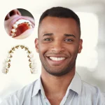 Tips To Avoid Tooth Decay While Wearing Braces Or Aligners